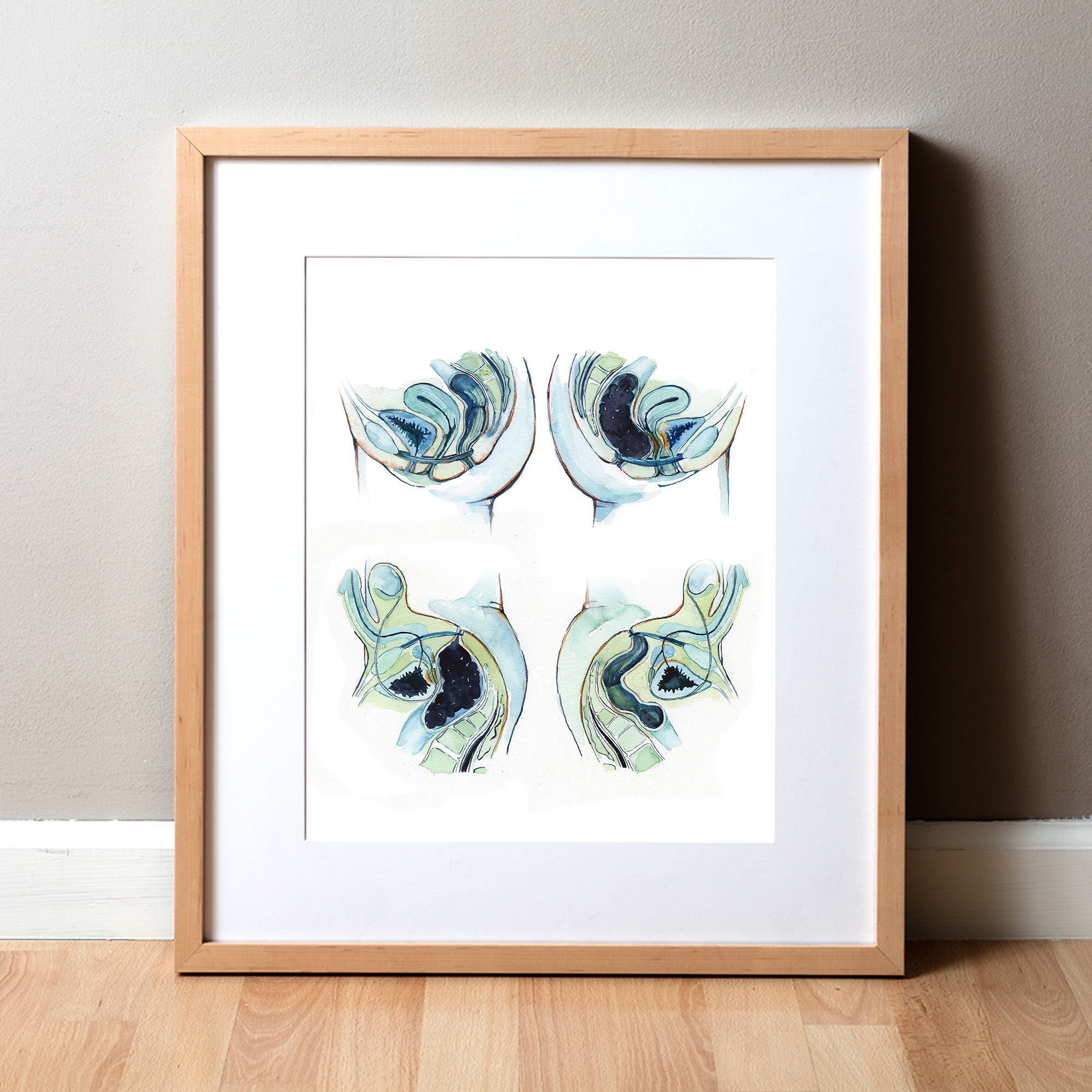 Constipation Cross Section Watercolor Print