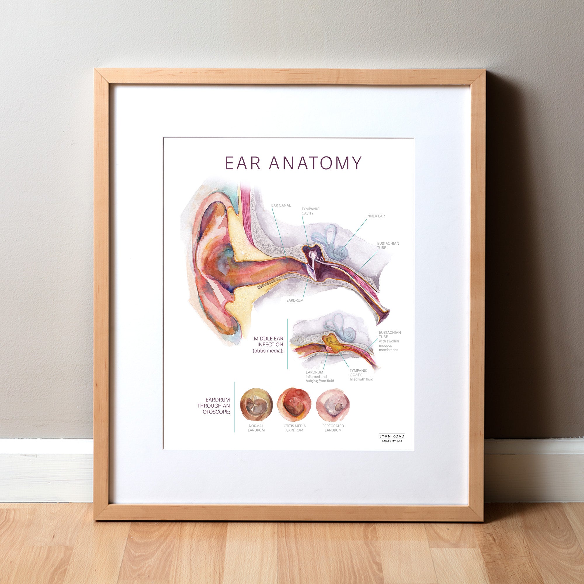 Framed poster of ear anatomy and middle ear infection on a wall