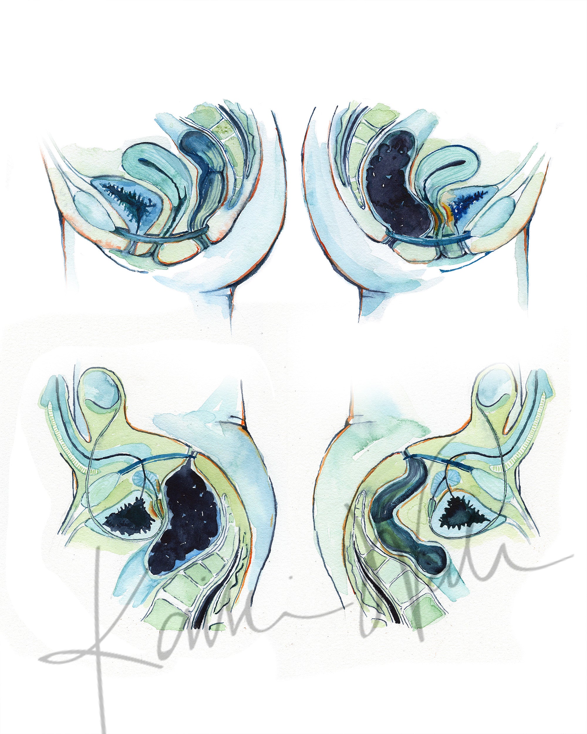 Constipation Cross Section Watercolor Print