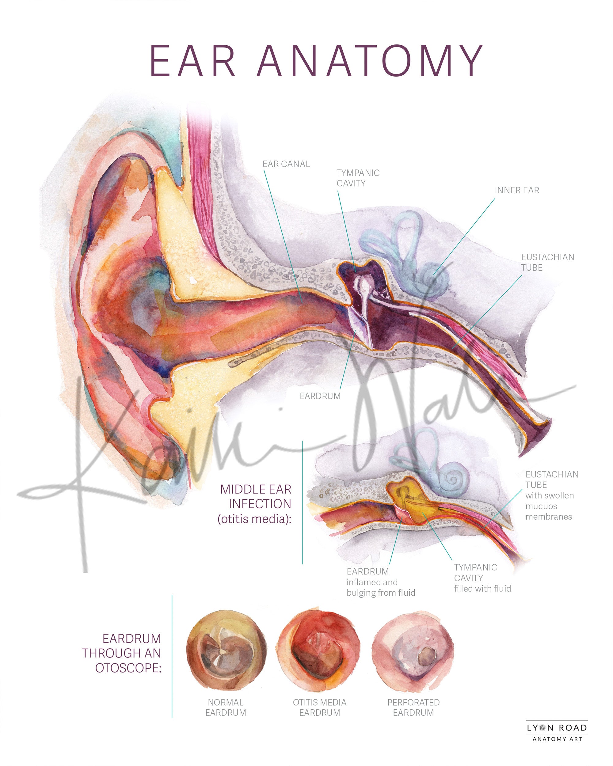 Ear Anatomy & Infection Pediatrics Diagram