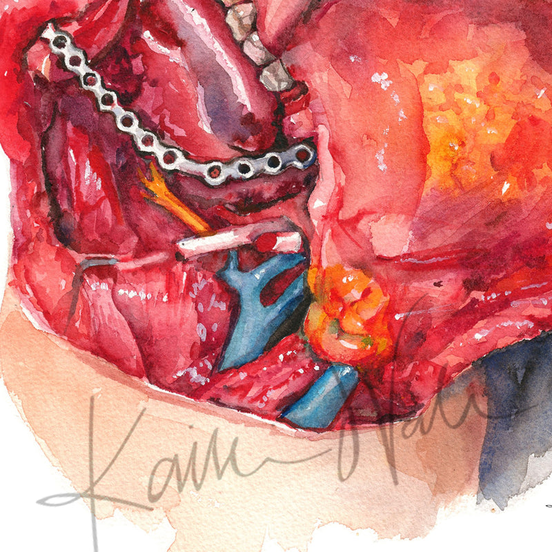 Neck Dissection II Watercolor Print - Lyon Road Art