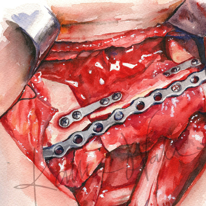 Neck Dissection I Watercolor Print - Lyon Road Art
