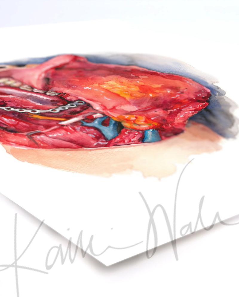 Neck Dissection II Watercolor Print - Lyon Road Art