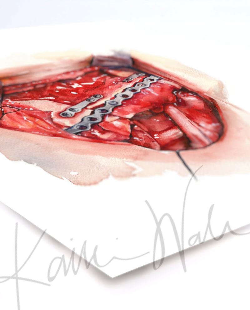 Neck Dissection I Watercolor Print - Lyon Road Art