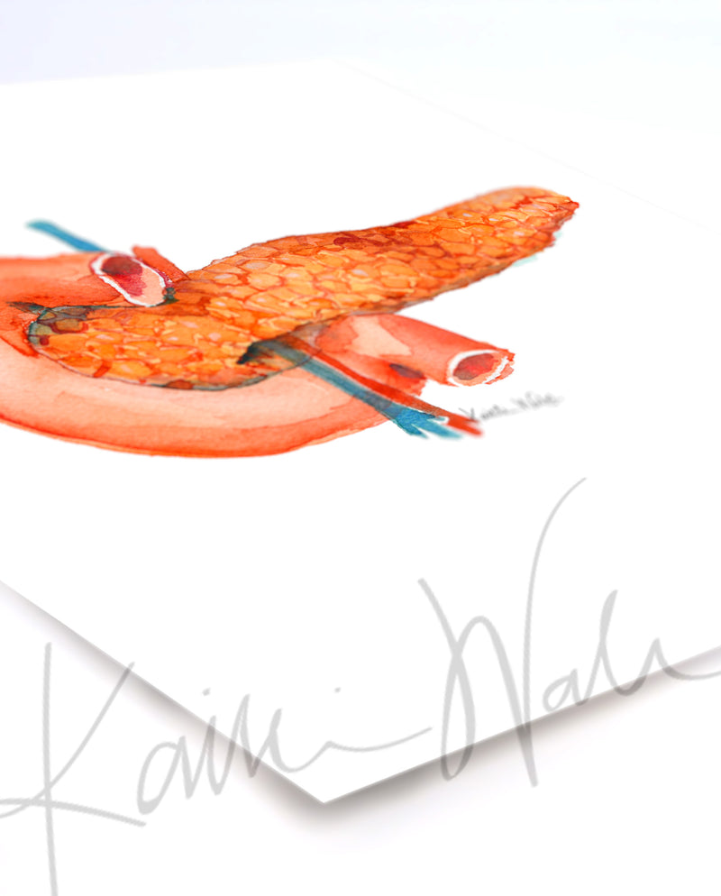 Anatomical Pancreas Watercolor Print - Lyon Road Art