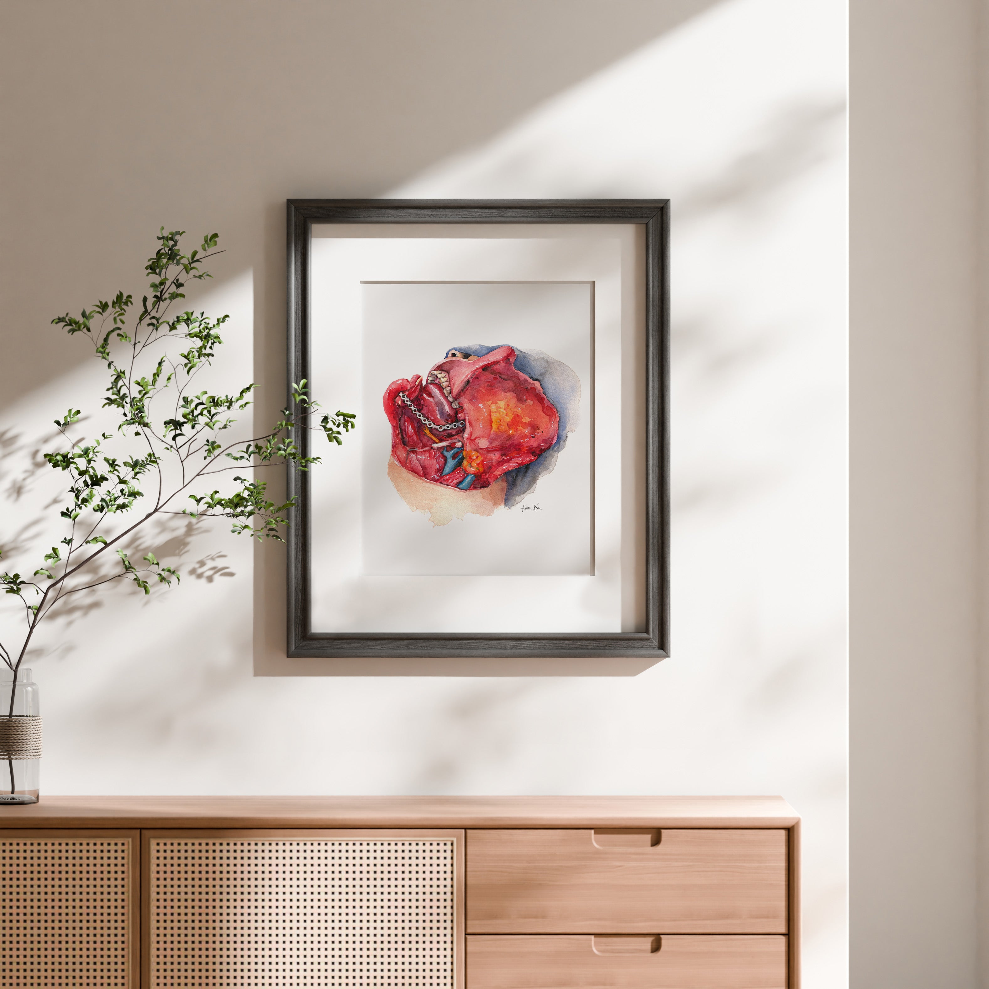 Neck Dissection II Watercolor Print - Lyon Road Art