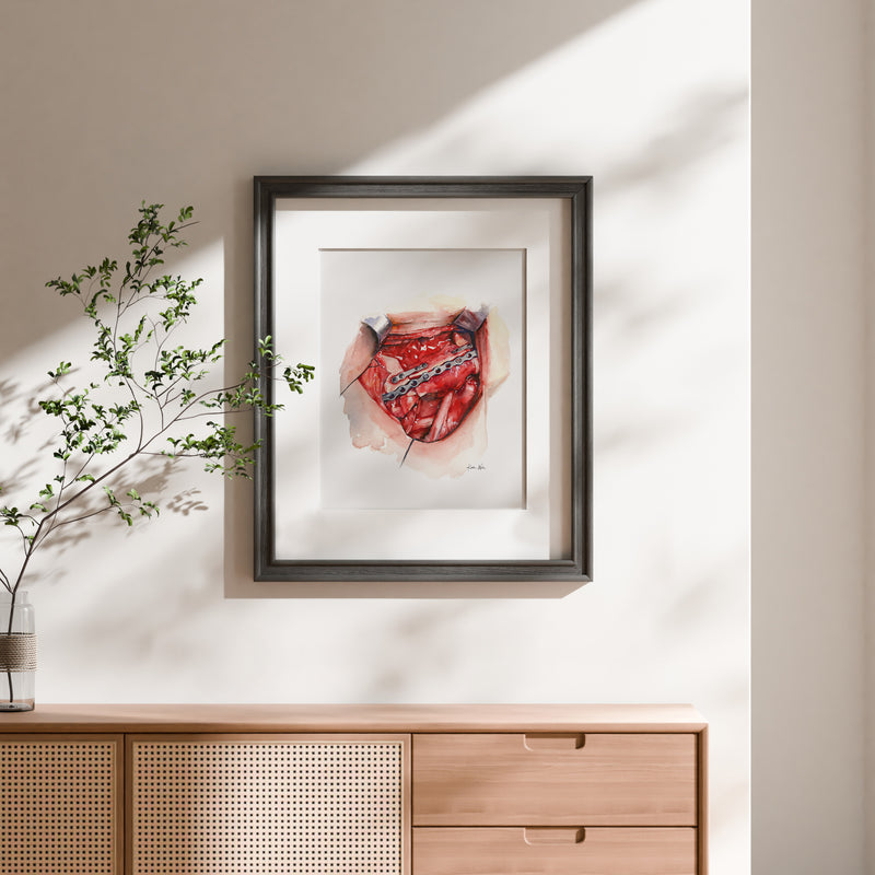Neck Dissection I Watercolor Print - Lyon Road Art