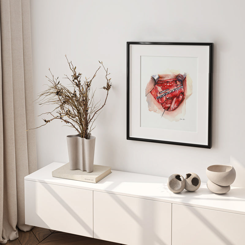 Neck Dissection I Watercolor Print - Lyon Road Art