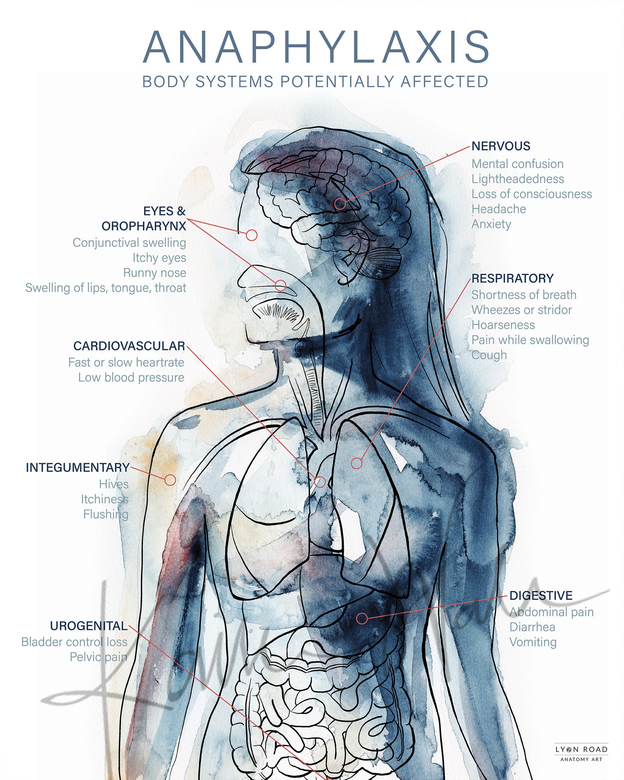 allergy diagram poster
