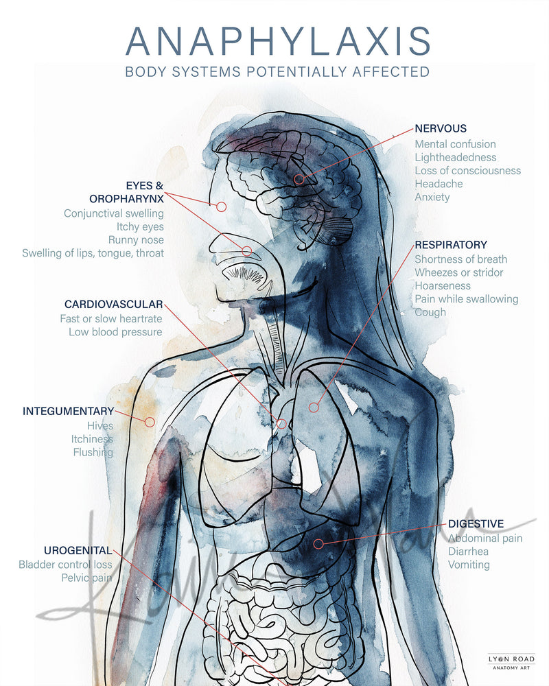 allergy diagram poster