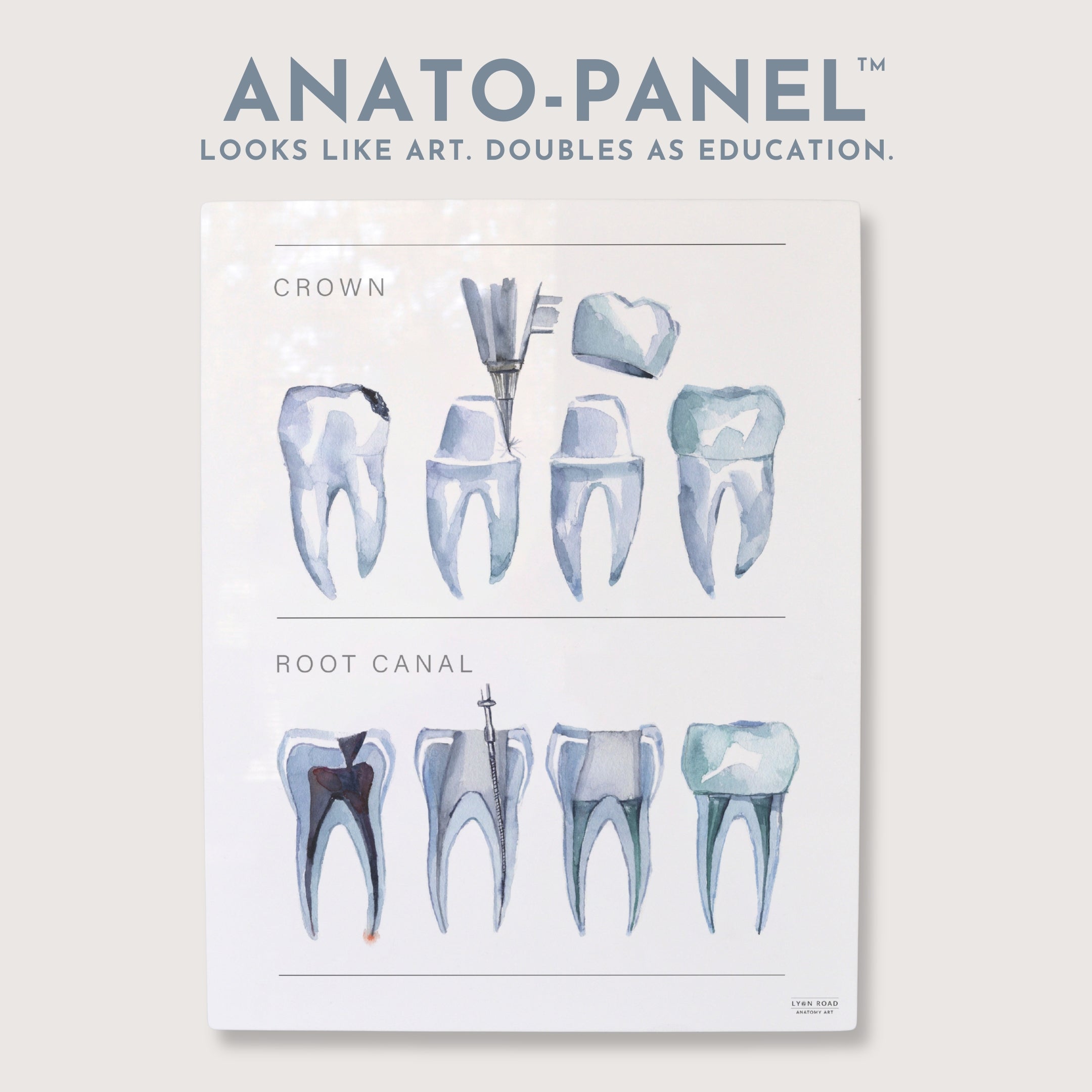 Crown & Root Canal Dental Diagram