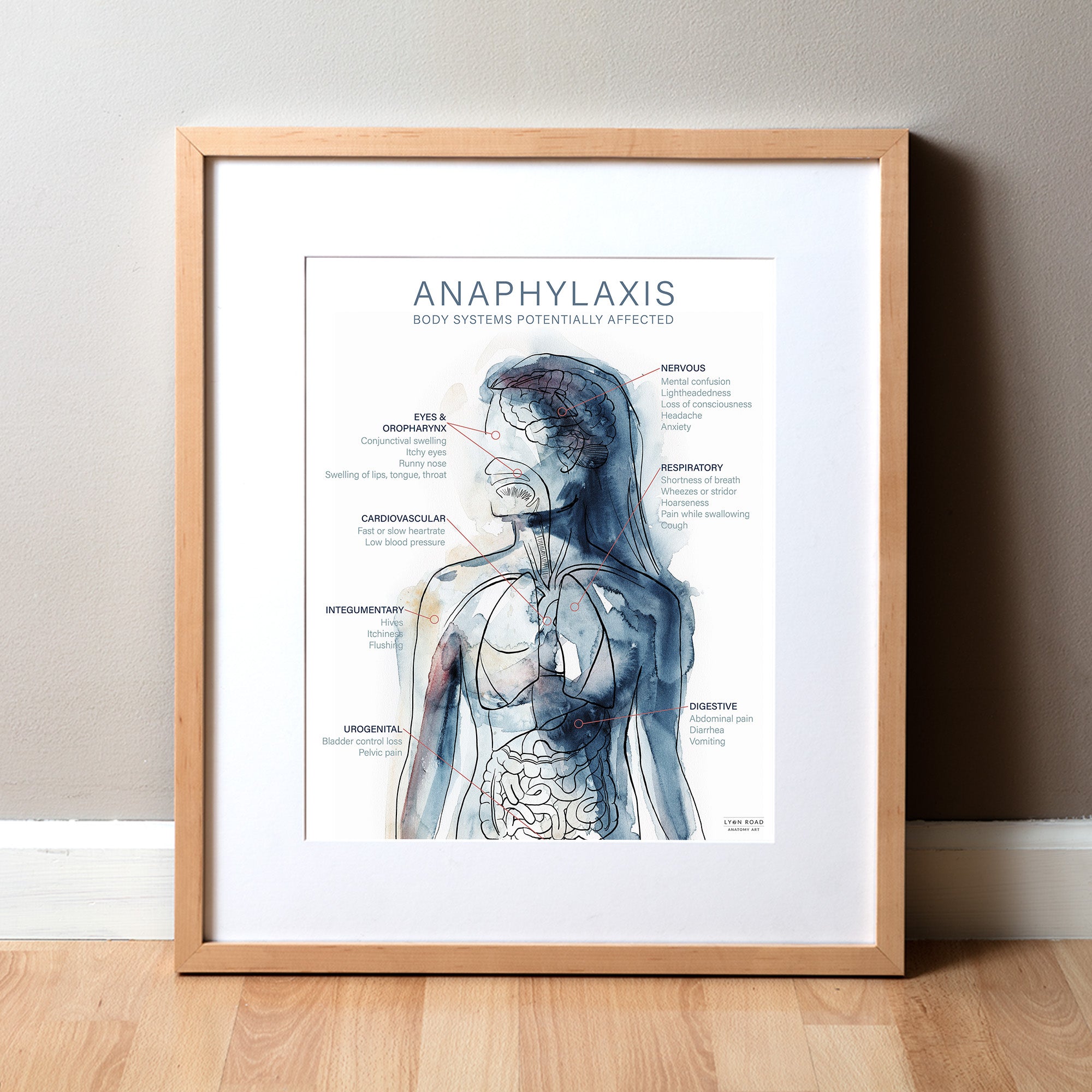 allergy poster framed in a wood frame