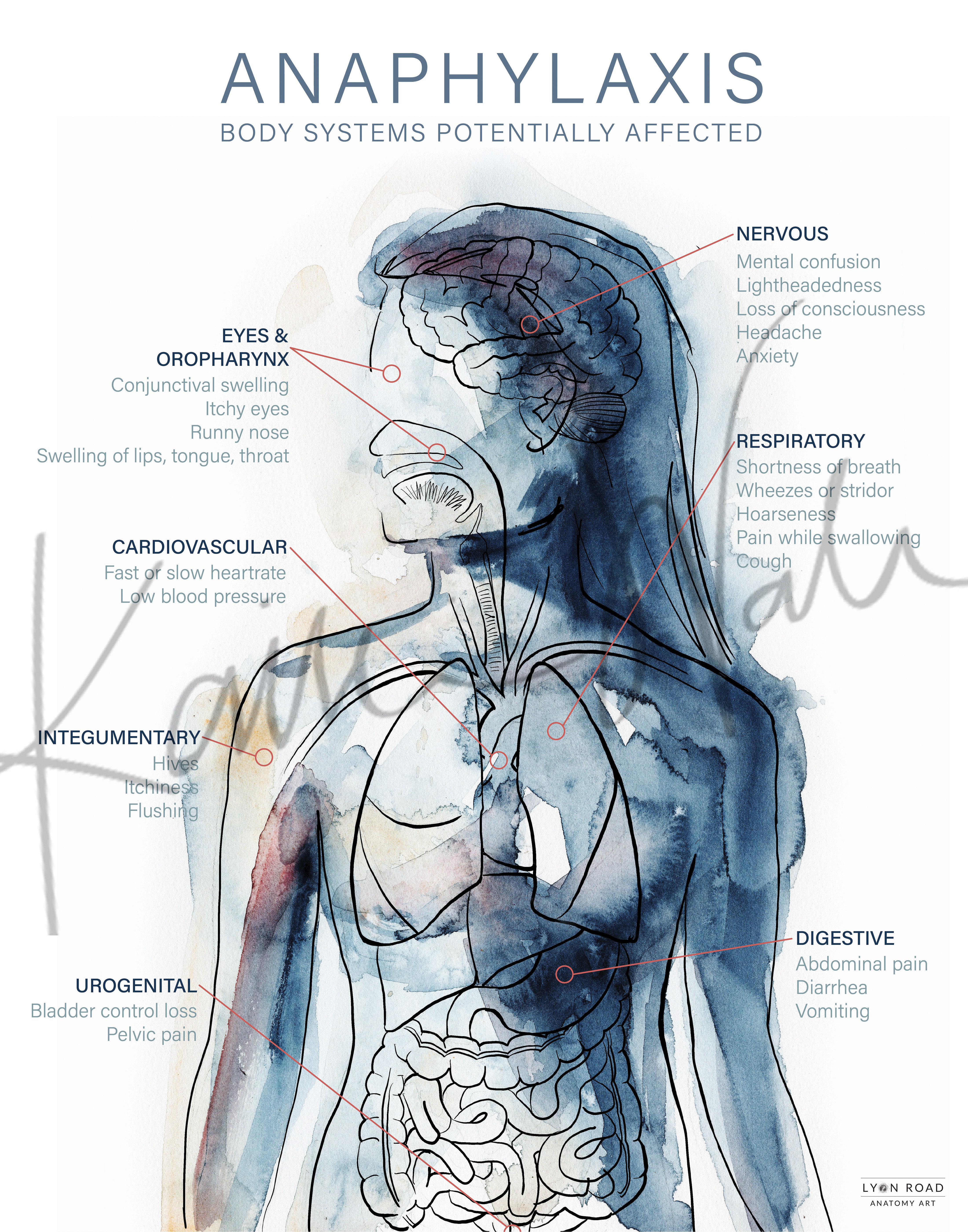 Anaphylaxis Allergy Medical Diagram