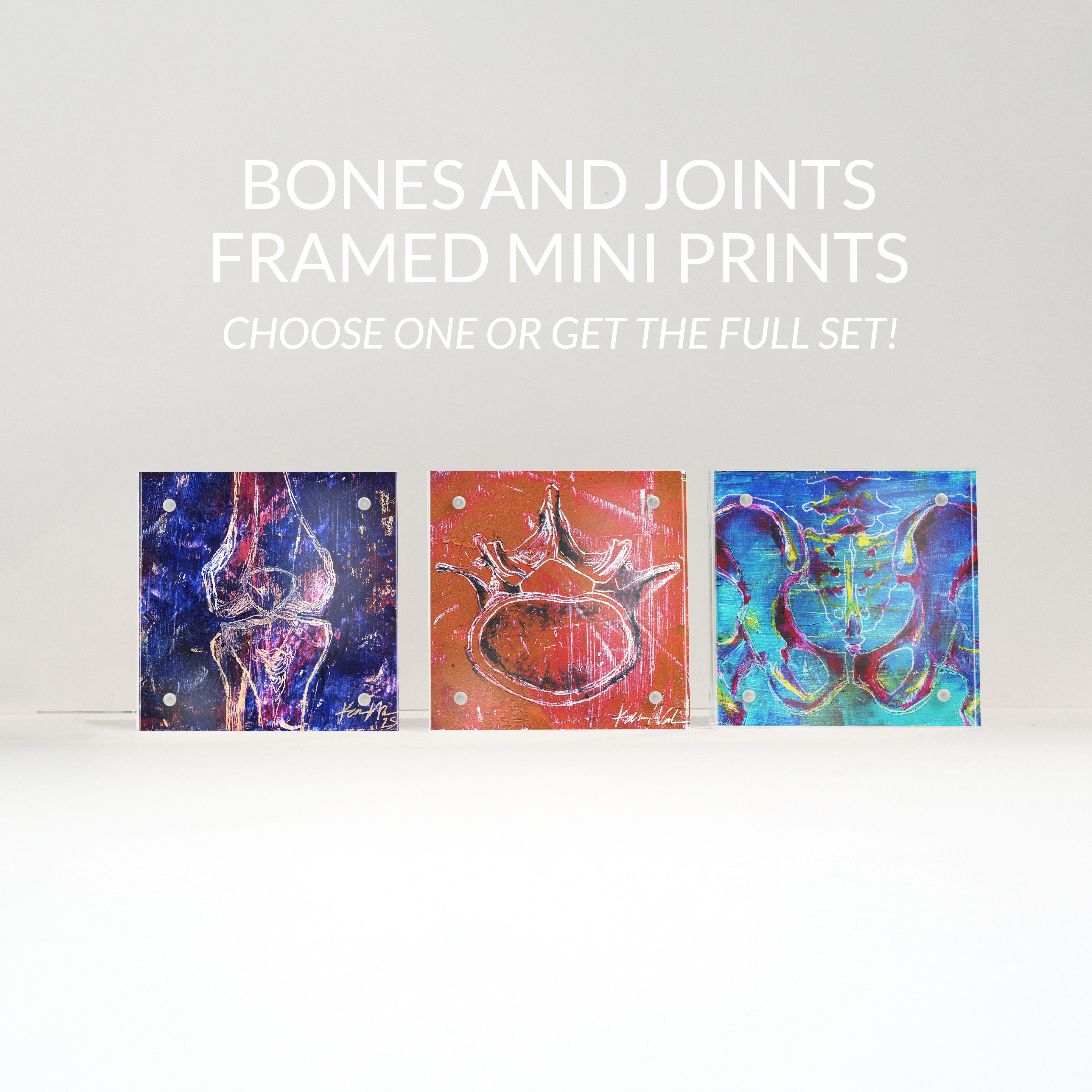 Bones and Joints Desktop Anatomy Art - Acrylic Framed Mini Print - Lyon Road Art
