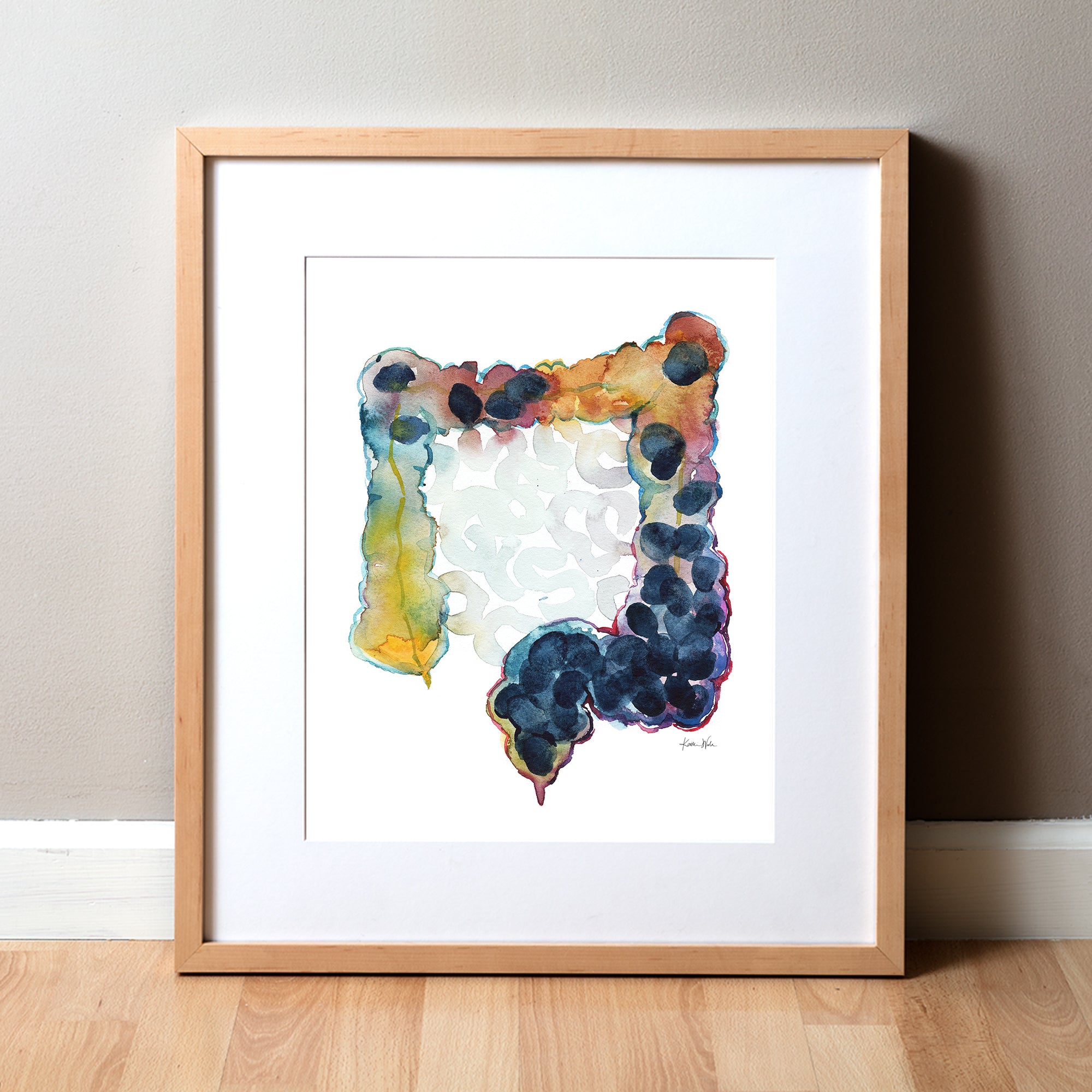 Framed watercolor abstract anatomy art showing a colon, or large intestine, that is constipated. Perfect for a pediatrician office or pediatrician gift or GI doctor art 