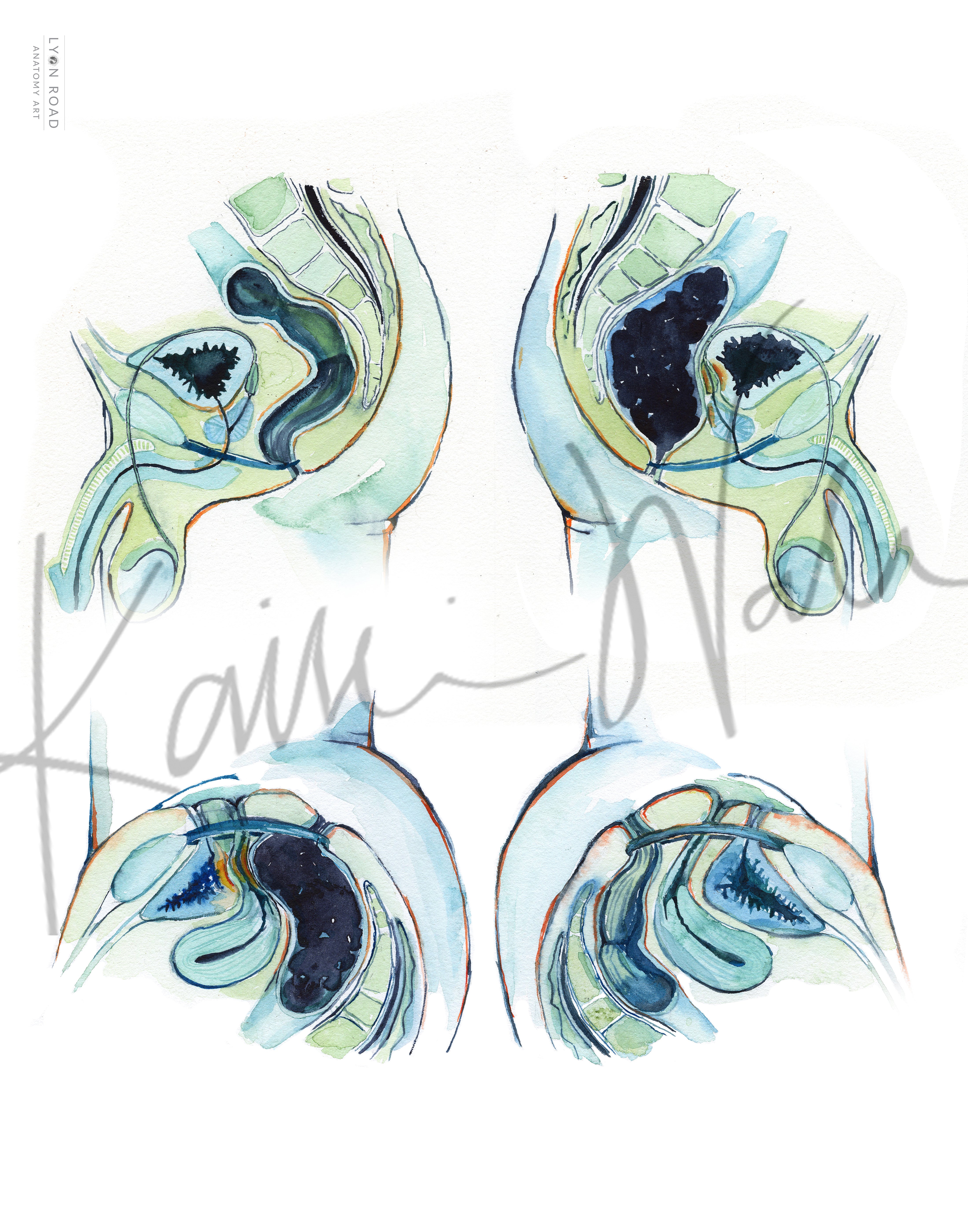 Anatomy of Constipation Gastrointestinal Diagram