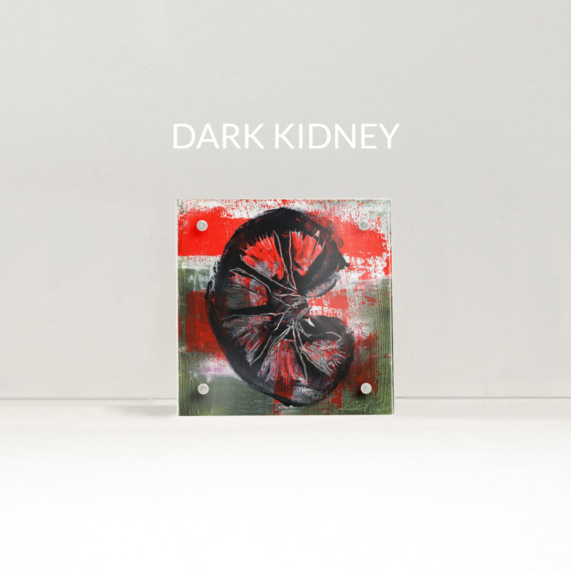 Urology Desktop Anatomy Art - Acrylic Framed Mini Print - Lyon Road Art