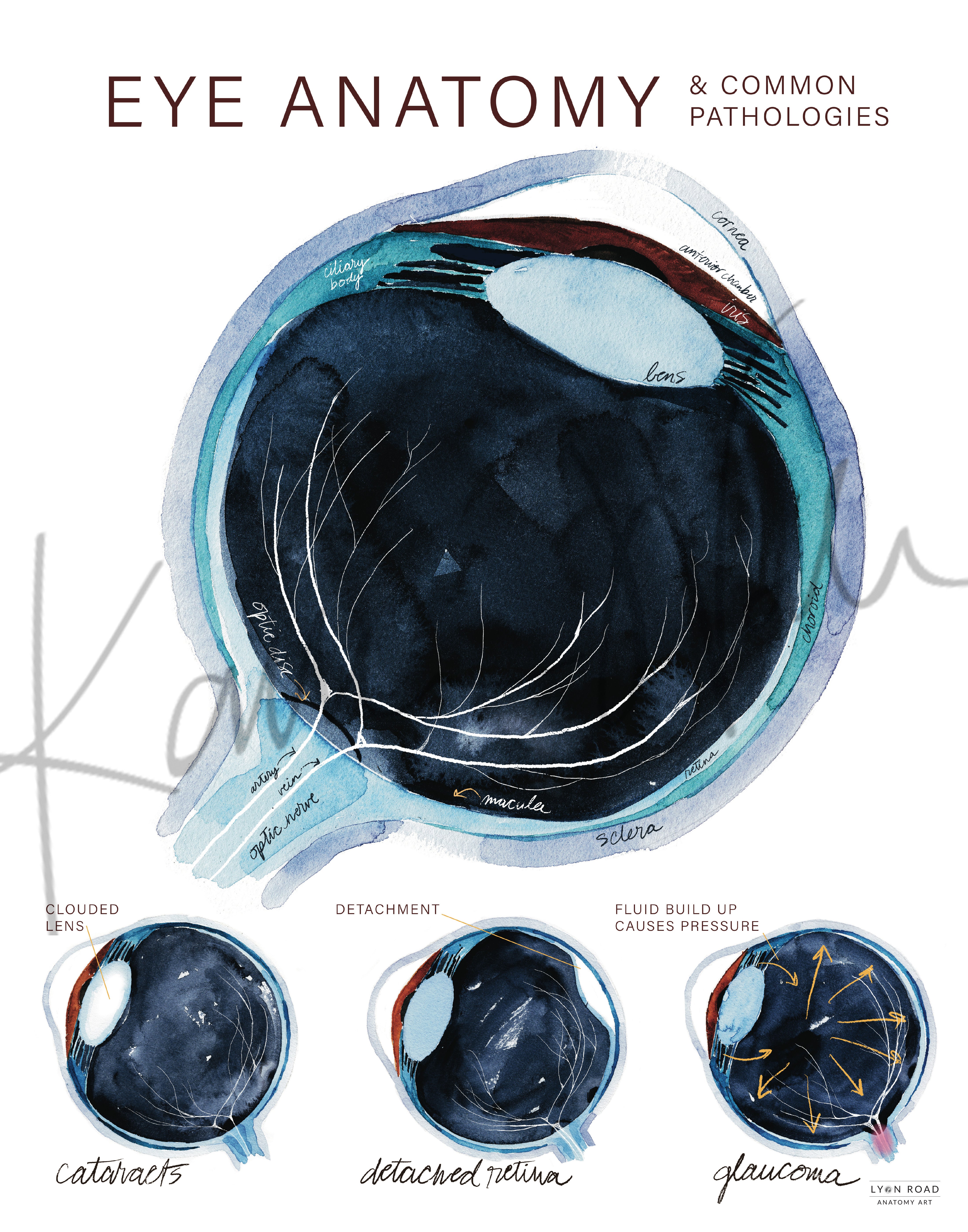 Eye Anatomy & Common Pathologies Diagram