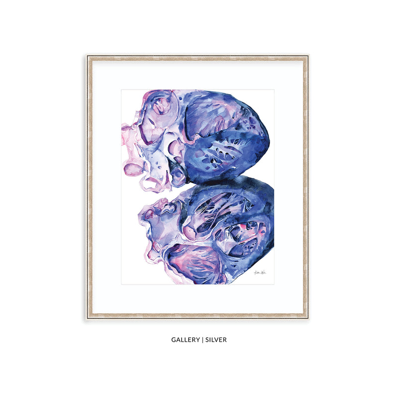 Professional Framing for Lyon Road Art Prints - Lyon Road Art
