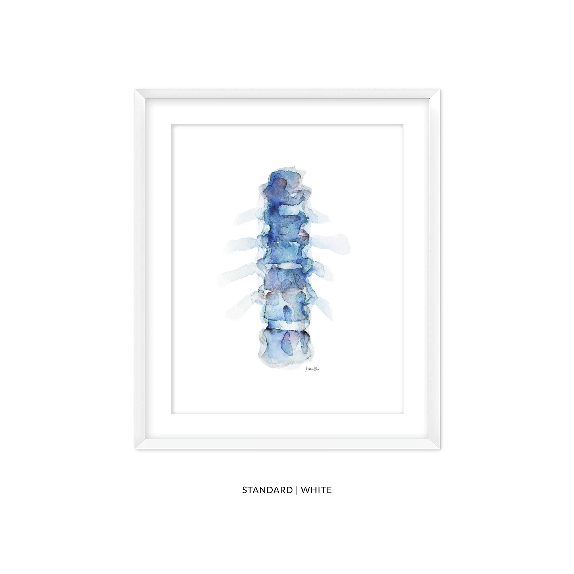 Professional Framing for Lyon Road Art Prints - Lyon Road Art