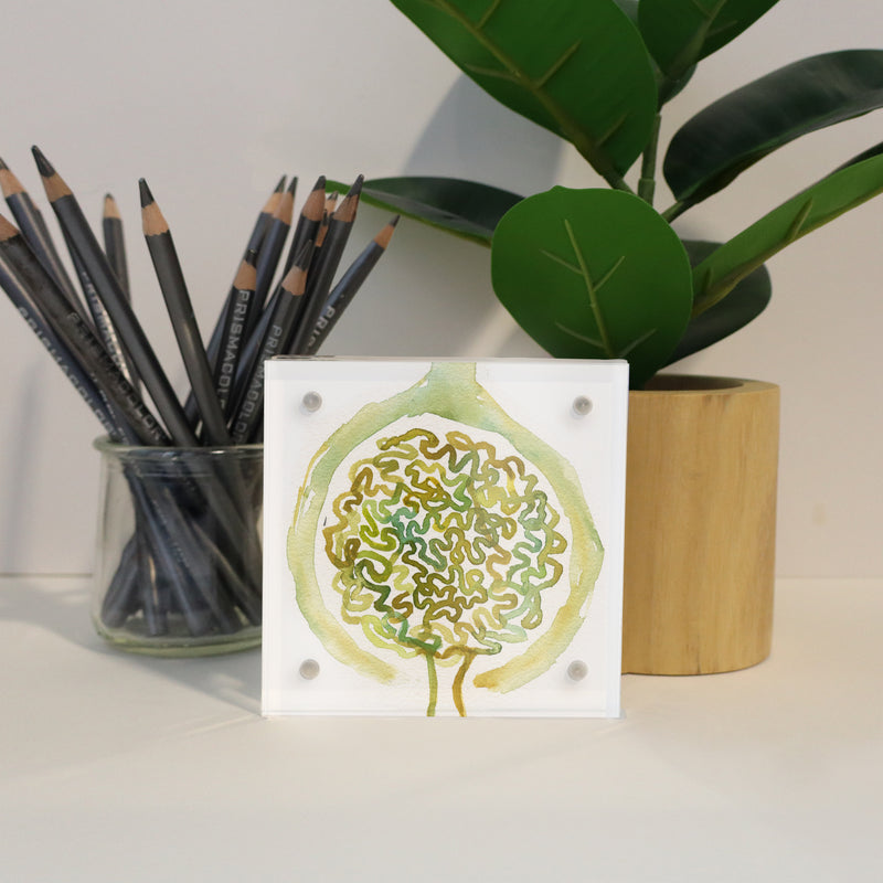 Urology Desktop Anatomy Art - Acrylic Framed Mini Print - Lyon Road Art