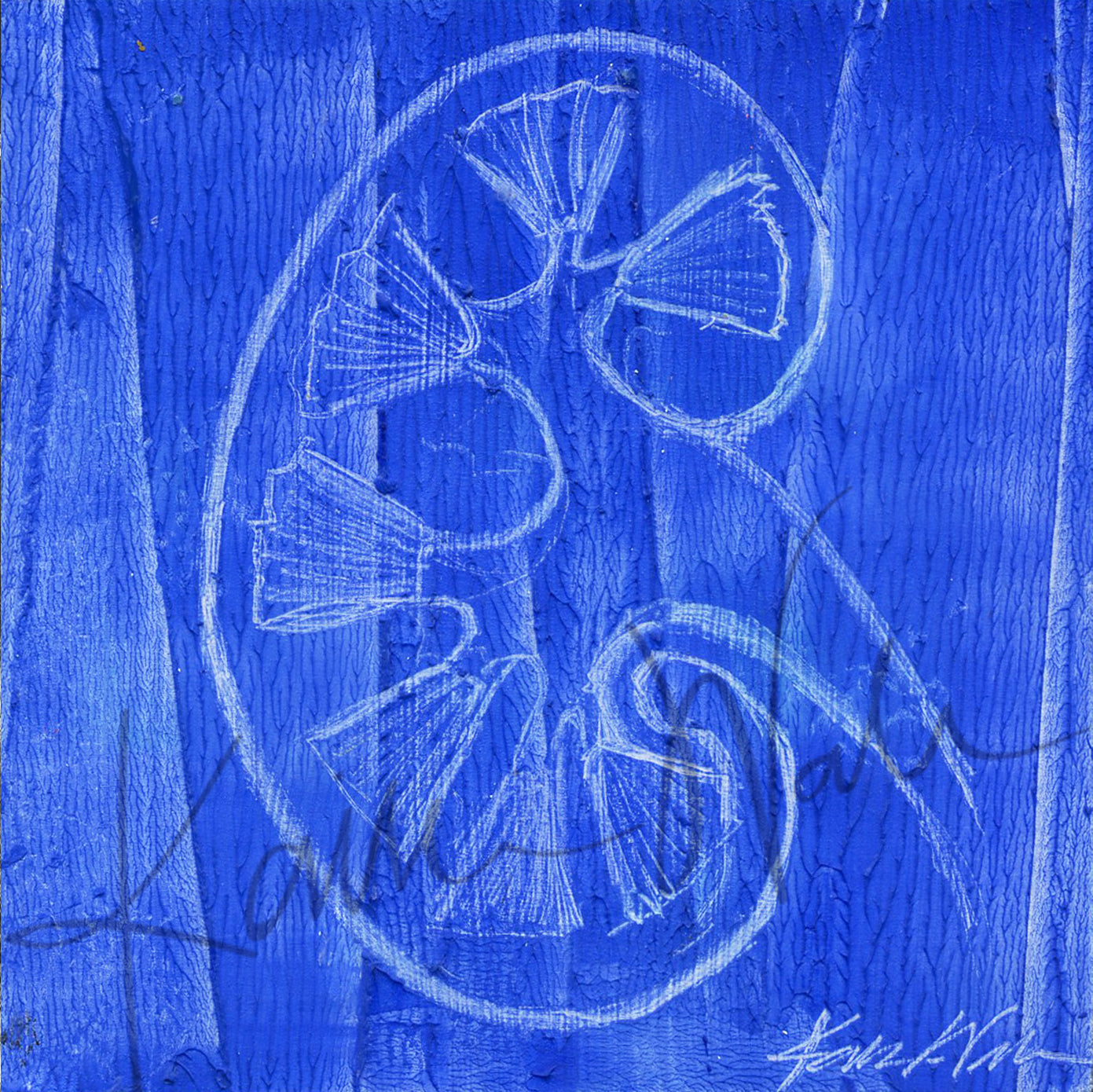 Urology Desktop Anatomy Art - Acrylic Framed Mini Print - Lyon Road Art