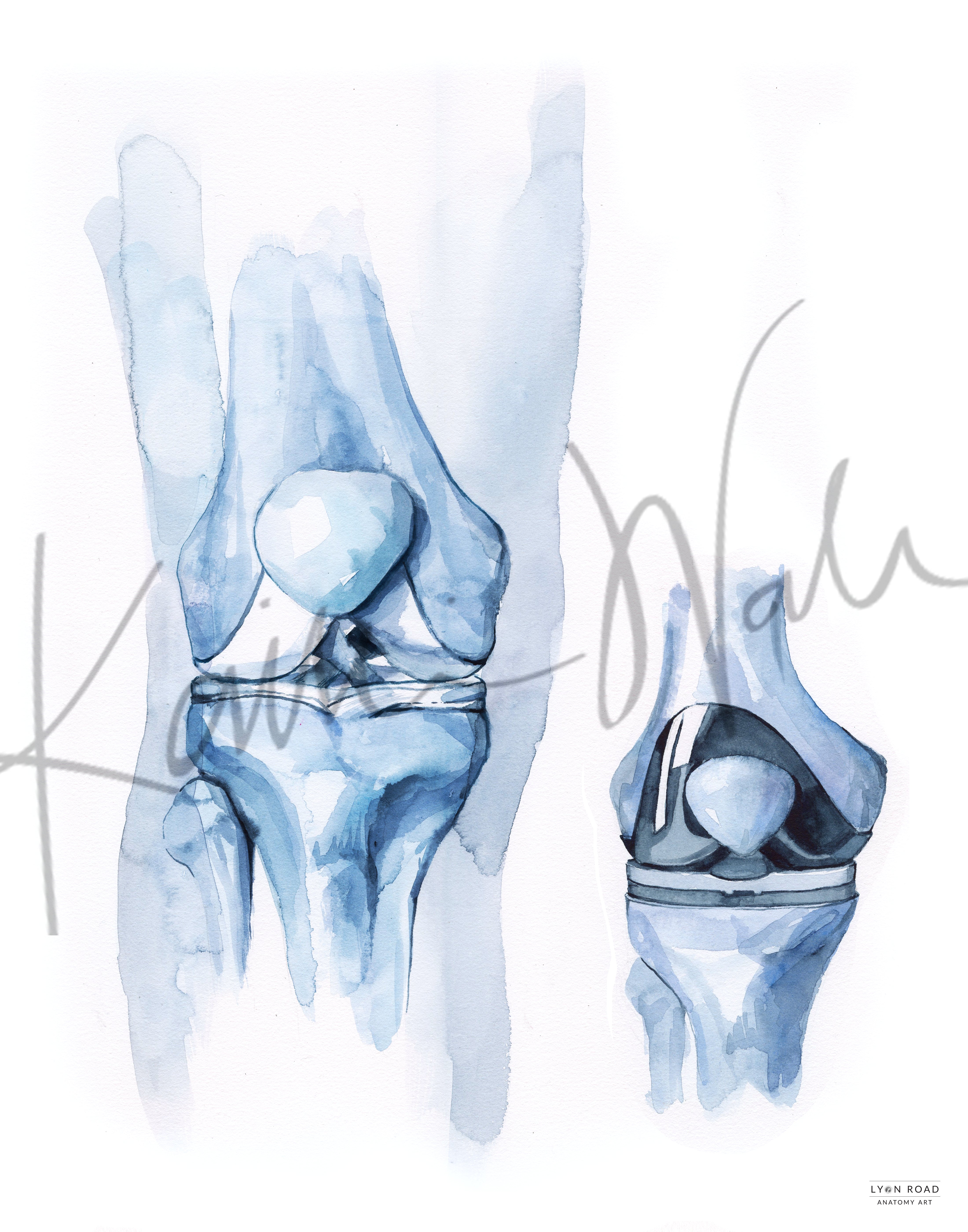 Knee Repair & Replacement Orthopedic Diagram