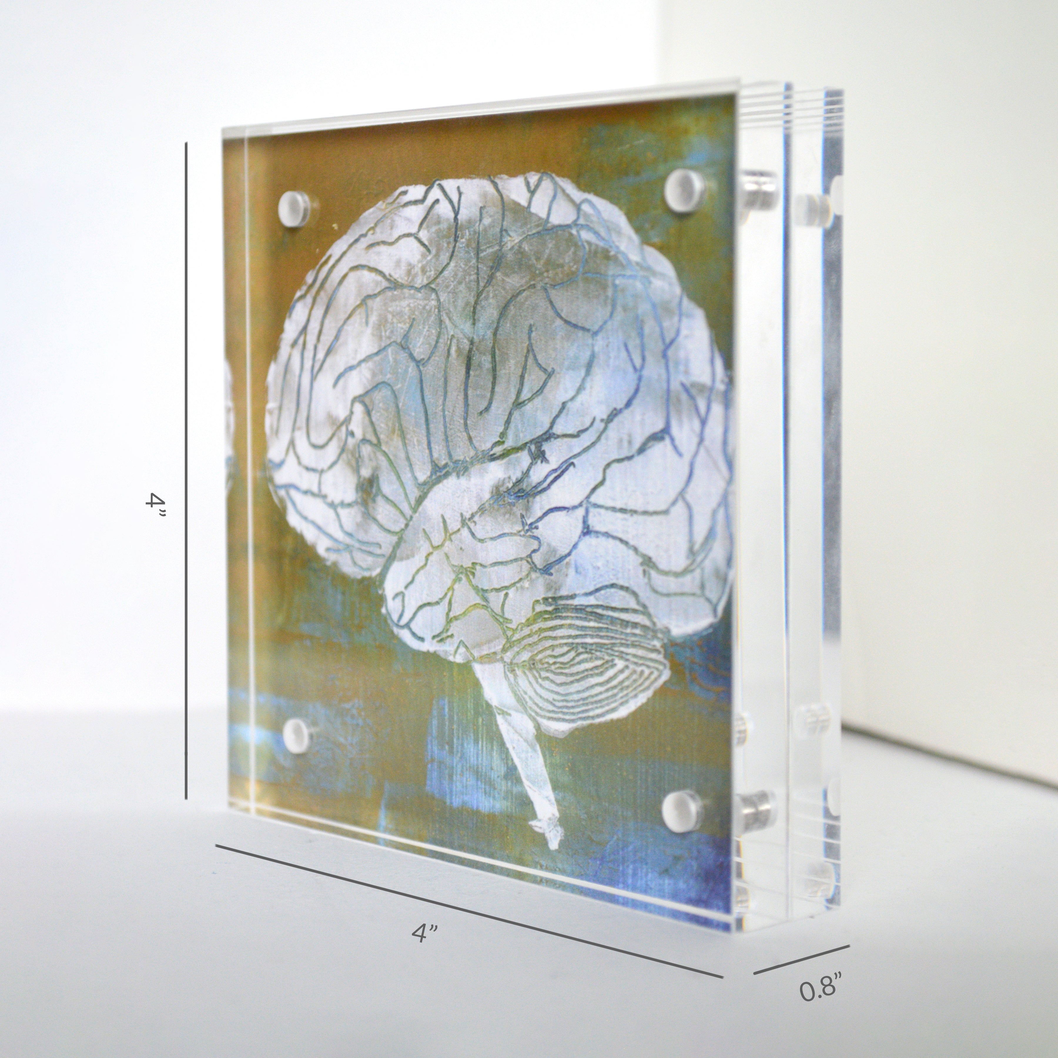 Urology Desktop Anatomy Art - Acrylic Framed Mini Print - Lyon Road Art