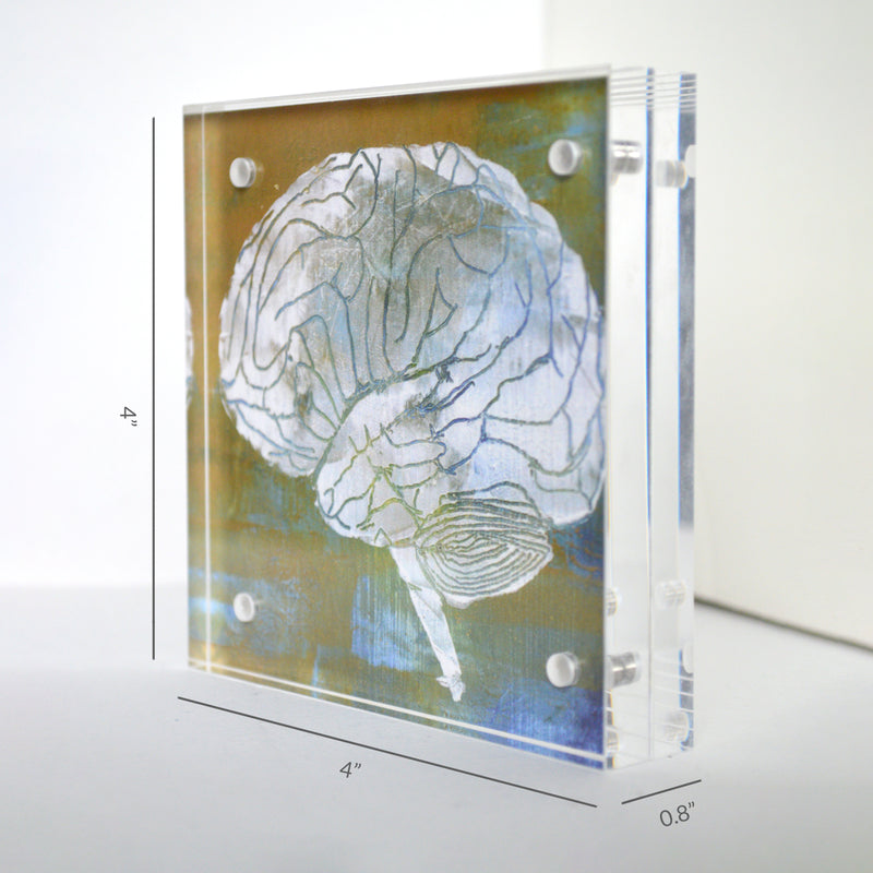 Urology Desktop Anatomy Art - Acrylic Framed Mini Print - Lyon Road Art
