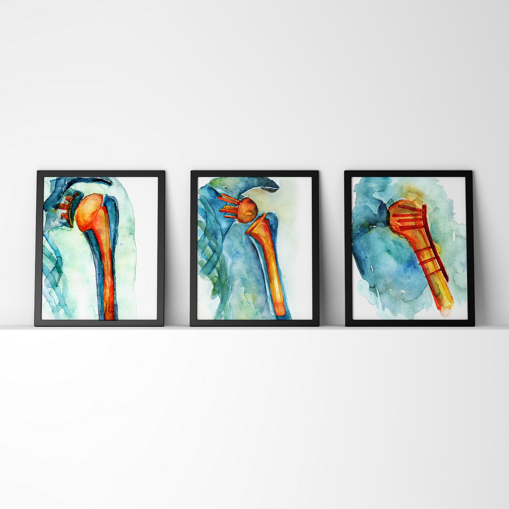 Orthopedic Hardware Watercolor Print Set - Lyon Road Art