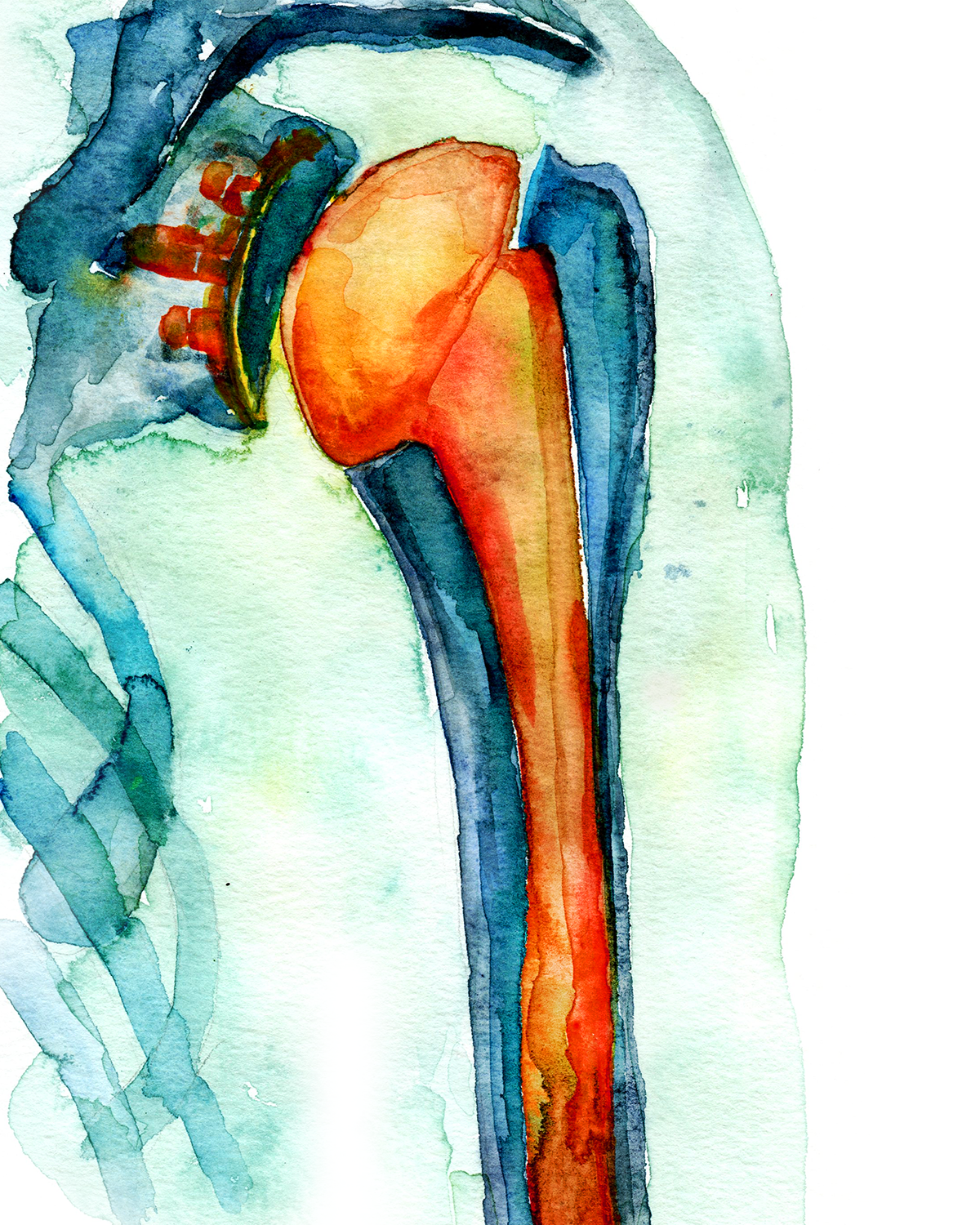 Orthopedic Hardware Watercolor Print Set - Lyon Road Art