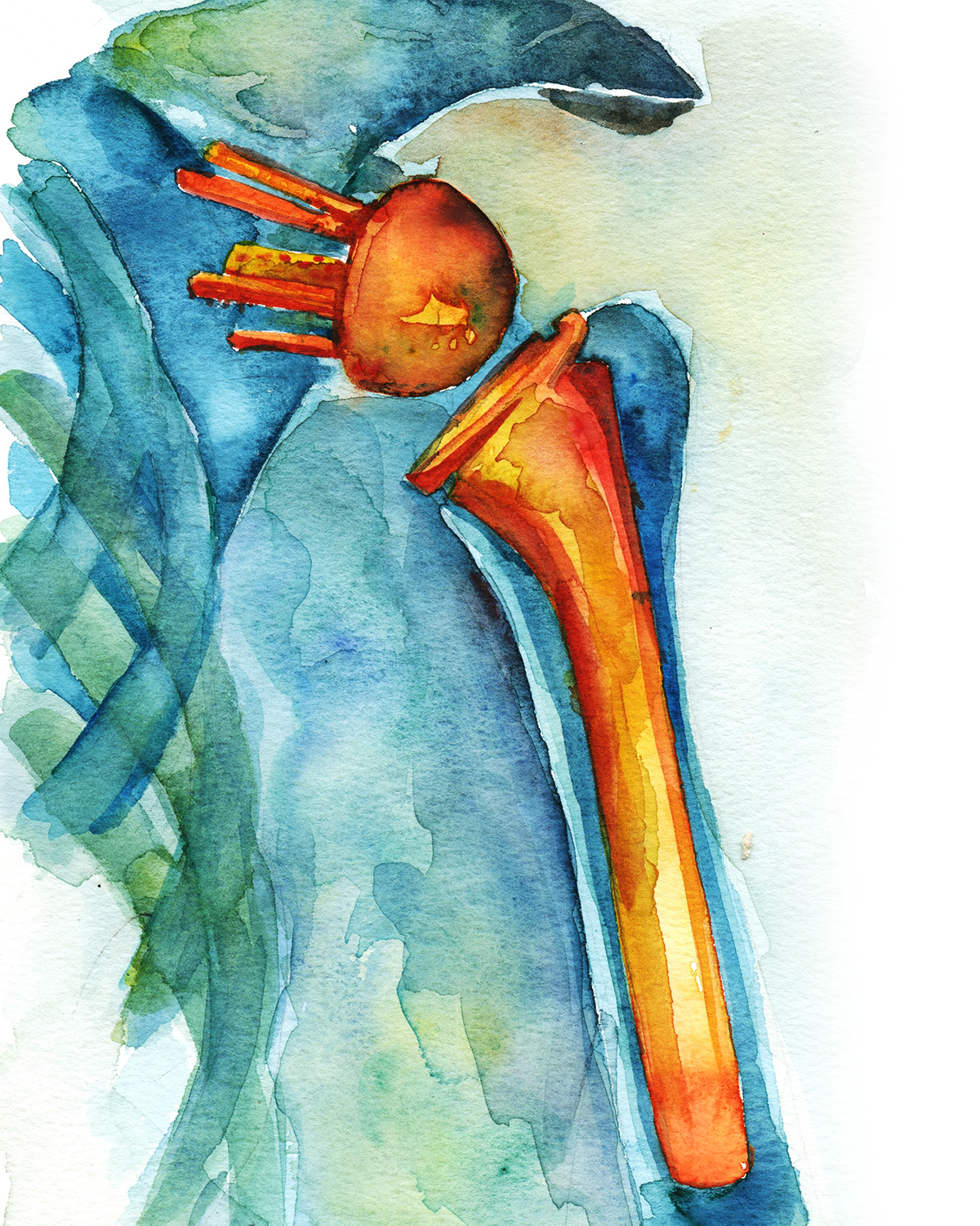 Orthopedic Hardware Watercolor Print Set - Lyon Road Art
