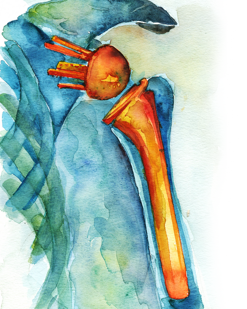 Orthopedic Hardware Watercolor Print Set - Lyon Road Art