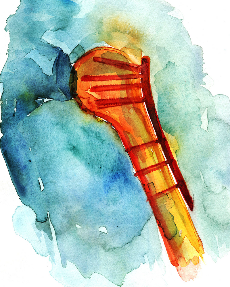 Orthopedic Hardware Watercolor Print Set - Lyon Road Art
