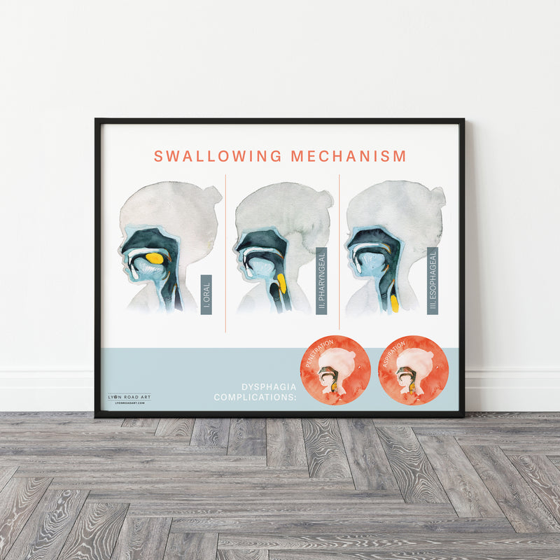 Framed educational poster on the swallowing mechanism displayed on a wall.