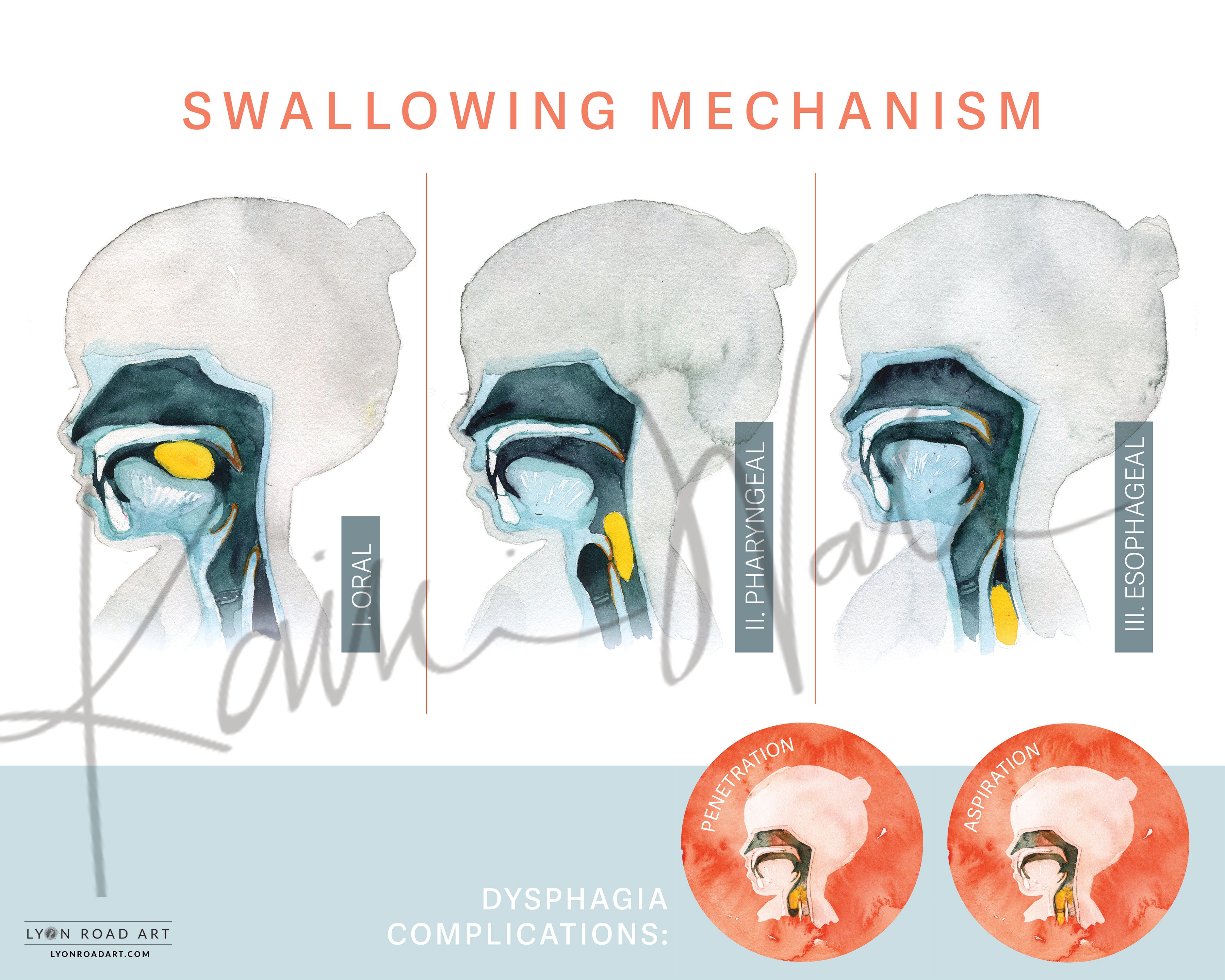 Poster of the swallowing mechanism with labeled stages and dysphagia complications.