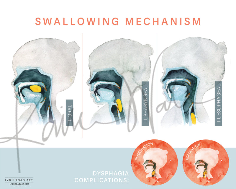 Poster of the swallowing mechanism with labeled stages and dysphagia complications.