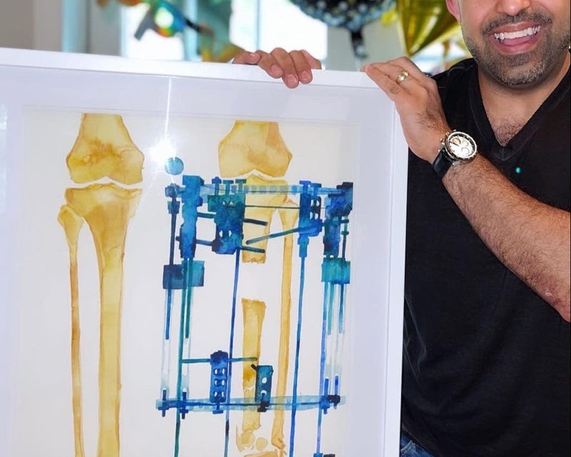 happy person holding a diagram of a bone with a blue mechanical component