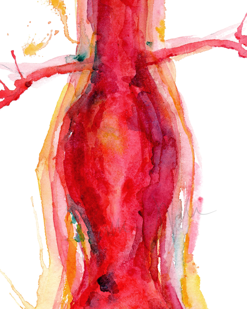 Abdominal Aneurysm Print Watercolor- Quality watercolor print- Professional- Gift for Doctor- Gift for Patient
