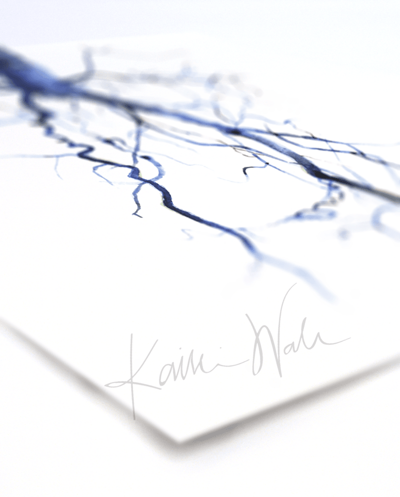 Aorta Angiogram Print Watercolor- Gift for Doctor- Anatomy Art- Gift for medical Student