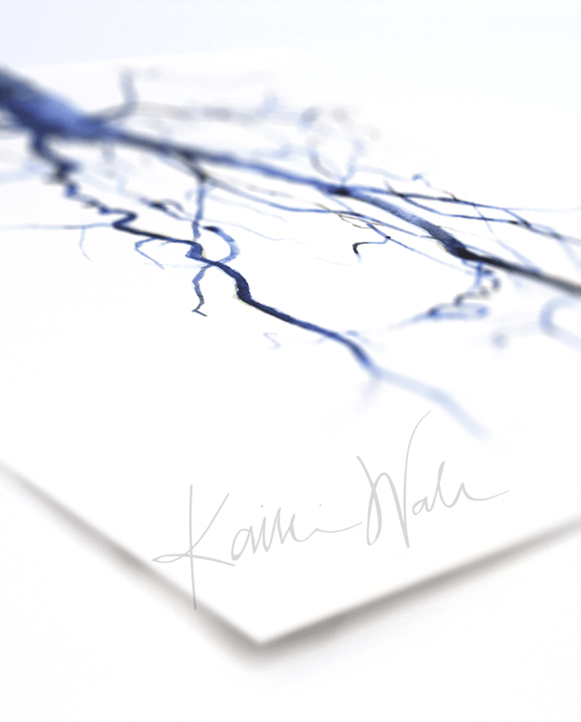 Aorta Angiogram Print Watercolor- Gift for Doctor- Anatomy Art- Gift for medical Student