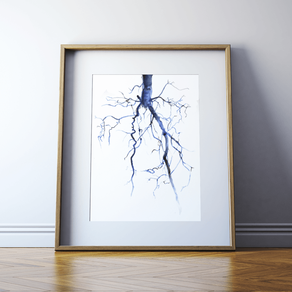 Aorta Angiogram Print Watercolor- descending aorta - common iliac arteries- Anatomy Art