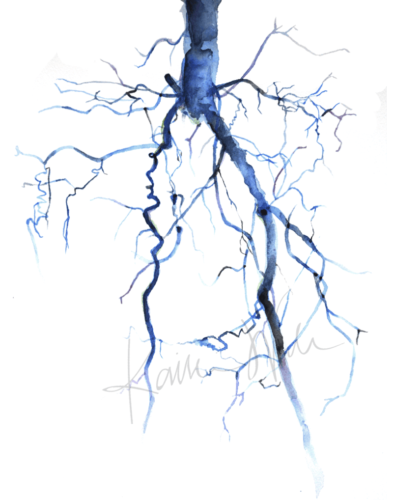 Aorta Angiogram Print Watercolor- descending aorta - common iliac arteries - Anatomy Art- Gift for Doctor- Cardiovascular art in blue