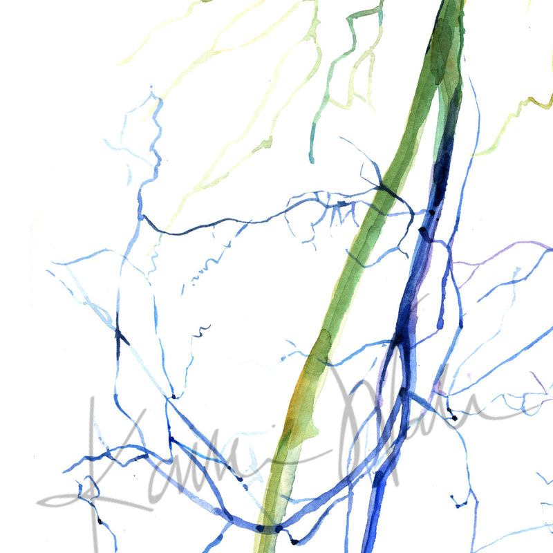 Zoomed in view of a watercolor painting of two angiograms combined into one. The painting shows the before of a blocked iliac artery and an after, unblocked iliac artery.