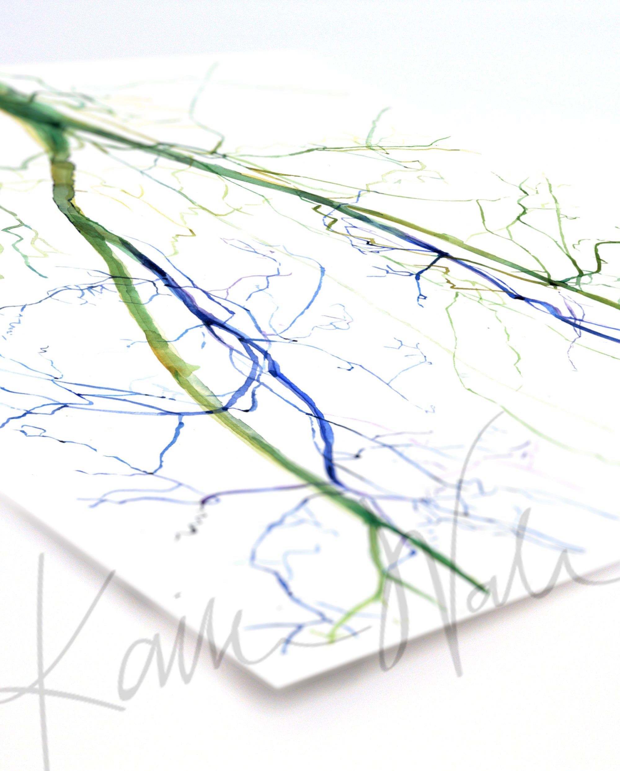 Unframed watercolor painting at an angle of two angiograms combined into one. The painting shows the before of a blocked iliac artery and an after, unblocked iliac artery.