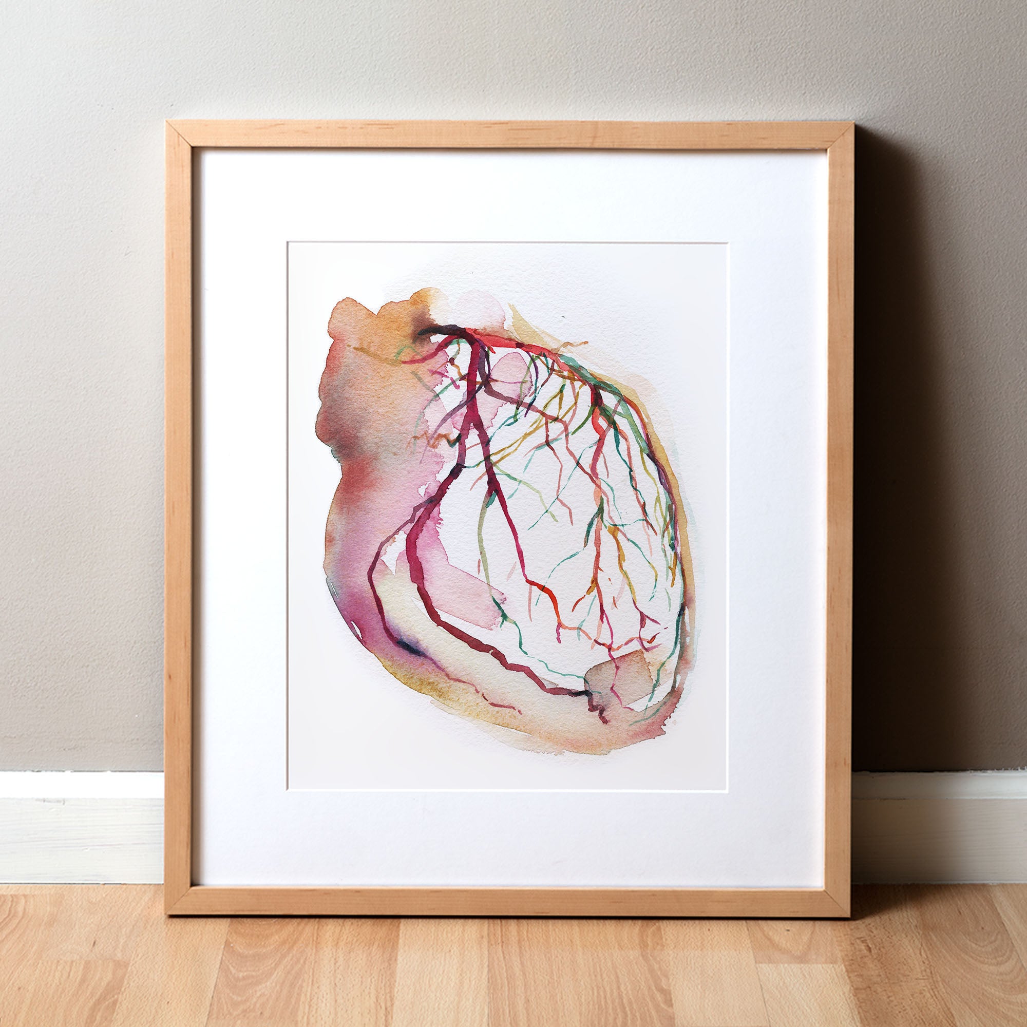 Framed abstract anatomy art watercolor painting showing a coronary angiogram x-ray image in reds, purples, greens, oranges and yellows. A great doctor gift