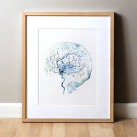 Cerebral Angiography Fine Art Watercolor Print. Abstract anatomy art that is a great medical or doctor gift.