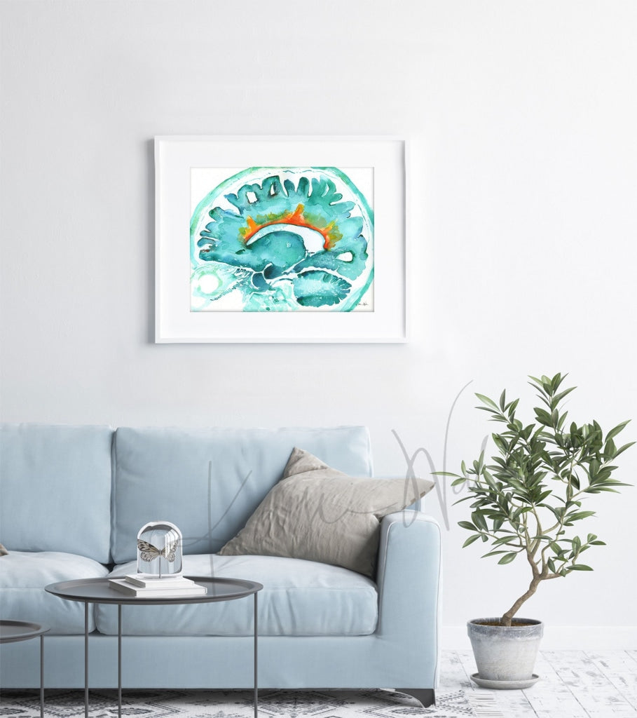 Dawsons Fingers Watercolor Print - Ms Art Multiple Sclerosis Painting Brain
