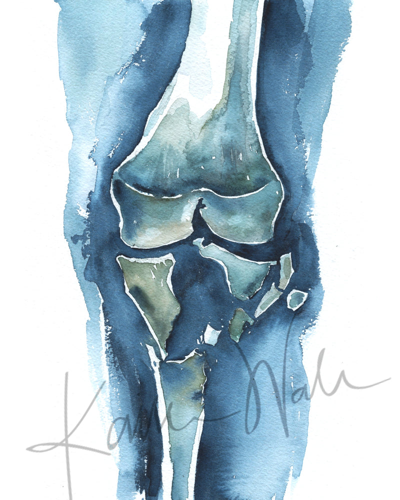 Unframed watercolor painting of a shattered knee.