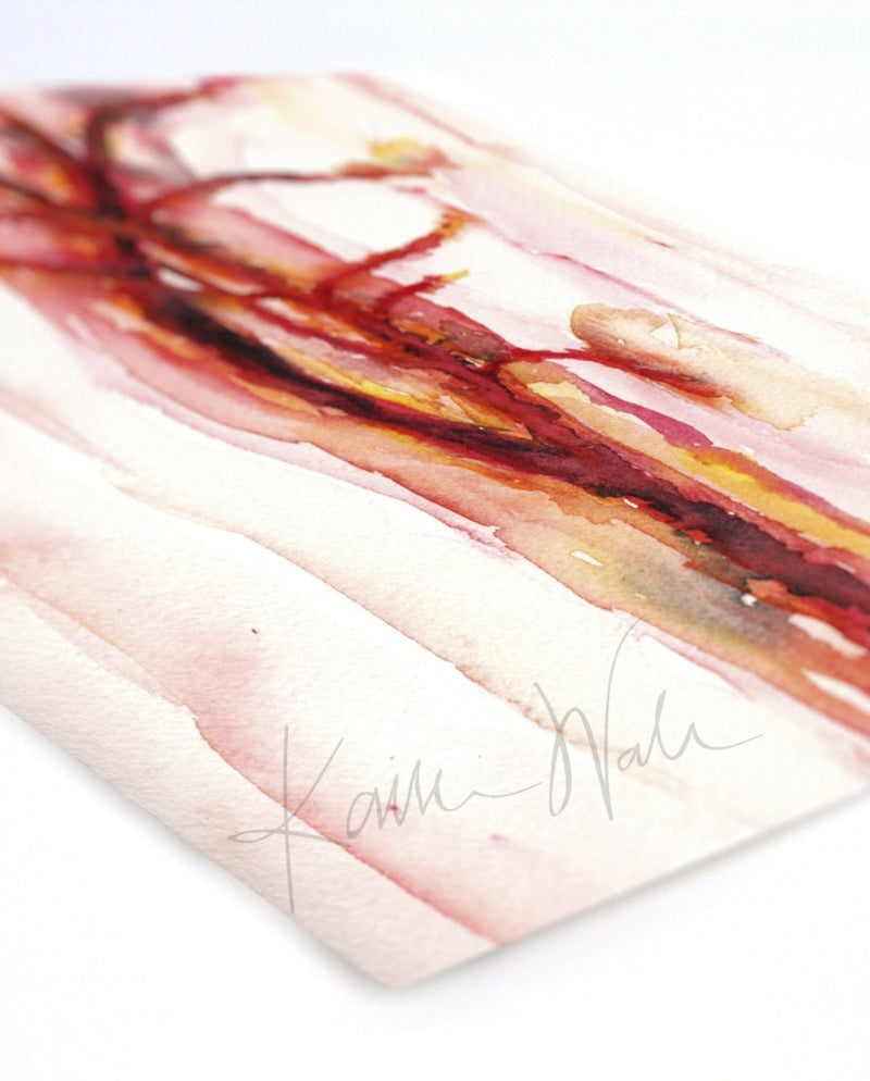 Abstract Carotid Print Watercolor- Quality Anatomical Print